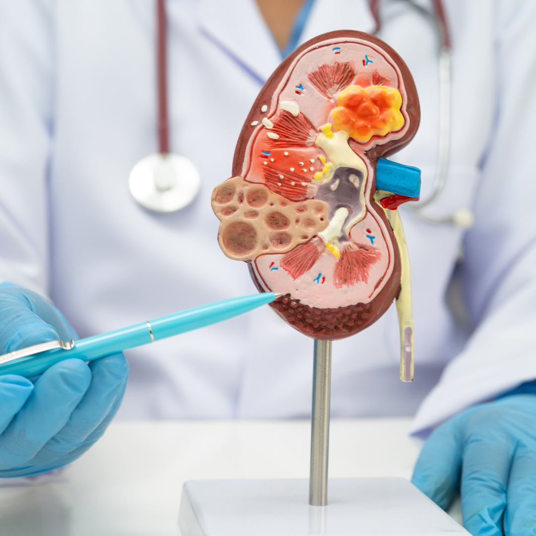 kidney disease department